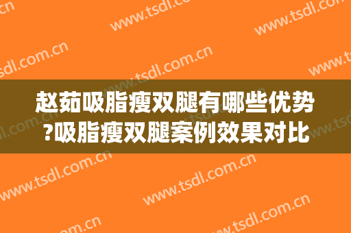 赵茹吸脂瘦双腿有哪些优势?吸脂瘦双腿案例效果对比图_中国医学科学院北京协和医院