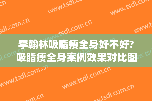 李翰林吸脂瘦全身好不好?吸脂瘦全身案例效果对比图_中国人民解放军总医院第四医学中心