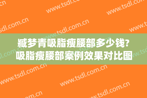 臧梦青吸脂瘦腰部多少钱?吸脂瘦腰部案例效果对比图_中国医学科学院整形外科医院