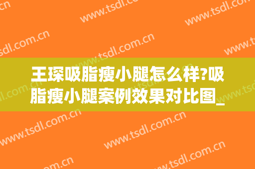 王琛吸脂瘦小腿怎么样?吸脂瘦小腿案例效果对比图_上海交通大学医学院附属第九人民医院