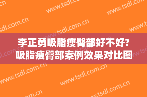 李正勇吸脂瘦臀部好不好?吸脂瘦臀部案例效果对比图_四川大学华西医院
