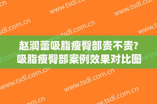 赵润蕾吸脂瘦臀部贵不贵?吸脂瘦臀部案例效果对比图_北京大学第三医院