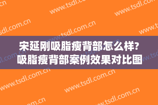 宋延刚吸脂瘦背部怎么样?吸脂瘦背部案例效果对比图_首都医科大学附属北京世纪坛医院