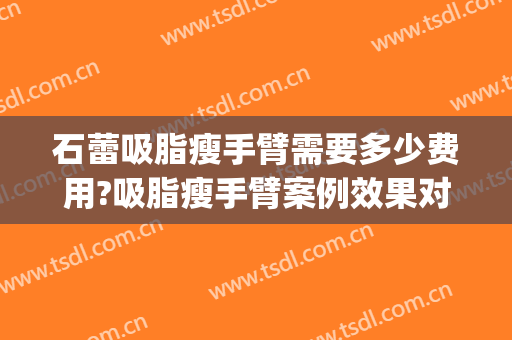 石蕾吸脂瘦手臂需要多少费用?吸脂瘦手臂案例效果对比图_中国医学科学院整形外科医院
