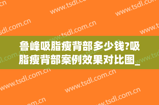 鲁峰吸脂瘦背部多少钱?吸脂瘦背部案例效果对比图_南方医科大学南方医院