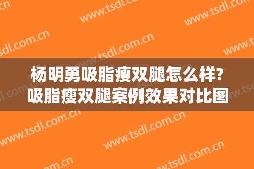杨明勇吸脂瘦双腿怎么样?吸脂瘦双腿案例效果对比图_中国医学科学院整形外科医院