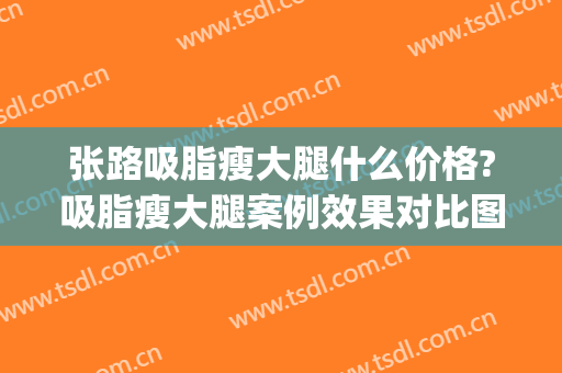 张路吸脂瘦大腿什么价格?吸脂瘦大腿案例效果对比图_上海交通大学医学院附属第九人民医院