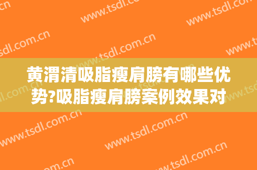黄渭清吸脂瘦肩膀有哪些优势?吸脂瘦肩膀案例效果对比图_中国医学科学院北京协和医院