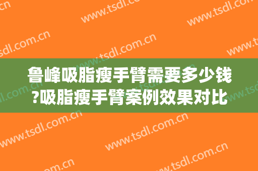 鲁峰吸脂瘦手臂需要多少钱?吸脂瘦手臂案例效果对比图_南方医科大学南方医院