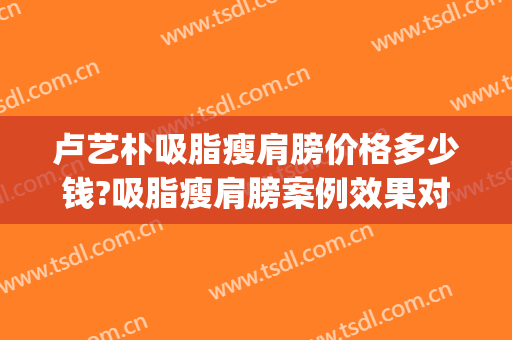 卢艺朴吸脂瘦肩膀价格多少钱?吸脂瘦肩膀案例效果对比图_厦门市中医院