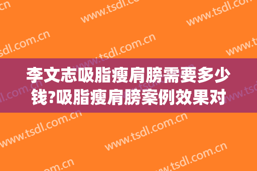 李文志吸脂瘦肩膀需要多少钱?吸脂瘦肩膀案例效果对比图_首都医科大学附属北京安贞医院