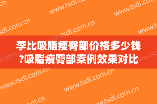 李比吸脂瘦臀部价格多少钱?吸脂瘦臀部案例效果对比图_北京大学第三医院