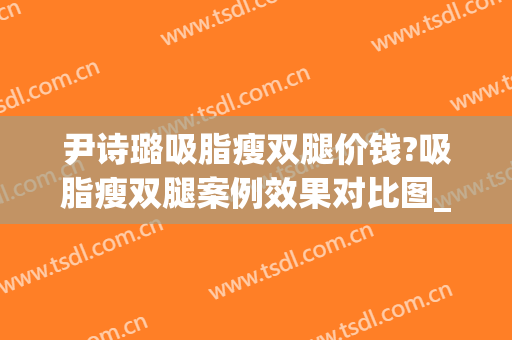 尹诗璐吸脂瘦双腿价钱?吸脂瘦双腿案例效果对比图_北京大学第三医院
