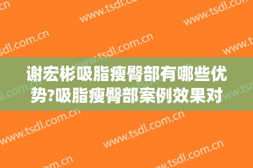 谢宏彬吸脂瘦臀部有哪些优势?吸脂瘦臀部案例效果对比图_北京大学第三医院