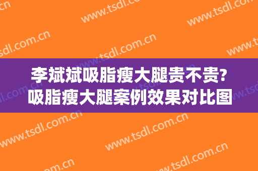 李斌斌吸脂瘦大腿贵不贵?吸脂瘦大腿案例效果对比图_首都医科大学附属北京安贞医院