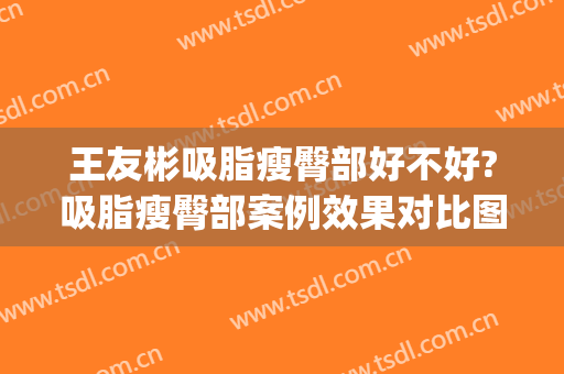 王友彬吸脂瘦臀部好不好?吸脂瘦臀部案例效果对比图_中国医学科学院北京协和医院