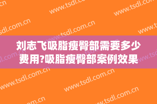 刘志飞吸脂瘦臀部需要多少费用?吸脂瘦臀部案例效果对比图_中国医学科学院北京协和医院