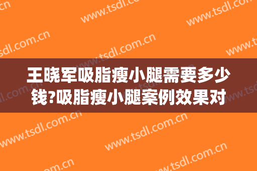 王晓军吸脂瘦小腿需要多少钱?吸脂瘦小腿案例效果对比图_中国医学科学院北京协和医院