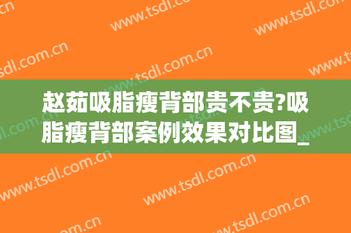 赵茹吸脂瘦背部贵不贵?吸脂瘦背部案例效果对比图_中国医学科学院北京协和医院