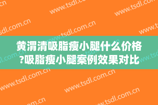 黄渭清吸脂瘦小腿什么价格?吸脂瘦小腿案例效果对比图_中国医学科学院北京协和医院