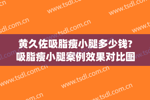 黄久佐吸脂瘦小腿多少钱?吸脂瘦小腿案例效果对比图_中国医学科学院北京协和医院