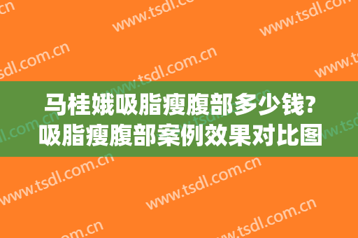 马桂娥吸脂瘦腹部多少钱?吸脂瘦腹部案例效果对比图_中国医学科学院整形外科医院