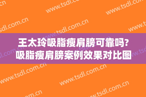 王太玲吸脂瘦肩膀可靠吗?吸脂瘦肩膀案例效果对比图_中国医学科学院整形外科医院