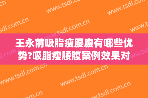 王永前吸脂瘦腰腹有哪些优势?吸脂瘦腰腹案例效果对比图_中国医学科学院整形外科医院