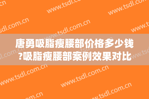 唐勇吸脂瘦腰部价格多少钱?吸脂瘦腰部案例效果对比图_中国医学科学院整形外科医院