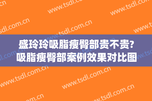 盛玲玲吸脂瘦臀部贵不贵?吸脂瘦臀部案例效果对比图_上海交通大学医学院附属第九人民医院