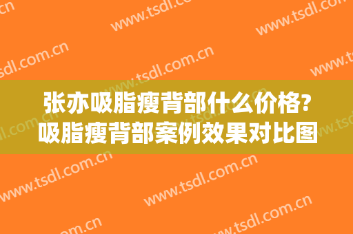 张亦吸脂瘦背部什么价格?吸脂瘦背部案例效果对比图_上海交通大学医学院附属第九人民医院