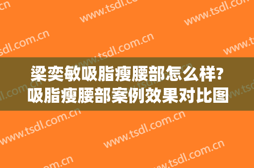 梁奕敏吸脂瘦腰部怎么样?吸脂瘦腰部案例效果对比图_上海交通大学医学院附属第九人民医院
