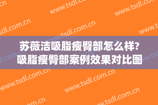 苏薇洁吸脂瘦臀部怎么样?吸脂瘦臀部案例效果对比图_上海交通大学医学院附属第九人民医院