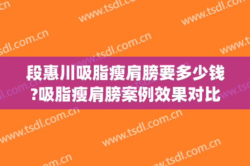 段惠川吸脂瘦肩膀要多少钱?吸脂瘦肩膀案例效果对比图_上海交通大学医学院附属第九人民医院