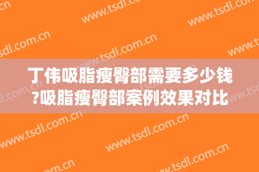 丁伟吸脂瘦臀部需要多少钱?吸脂瘦臀部案例效果对比图_上海交通大学医学院附属第九人民医院