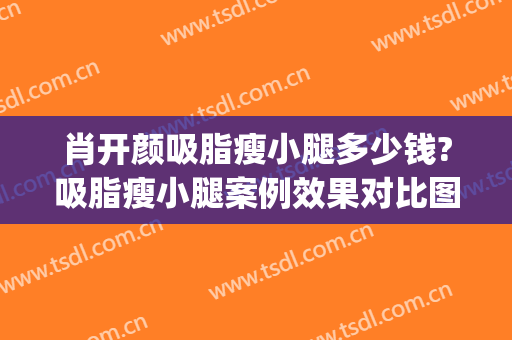 肖开颜吸脂瘦小腿多少钱?吸脂瘦小腿案例效果对比图_上海交通大学医学院附属第九人民医院