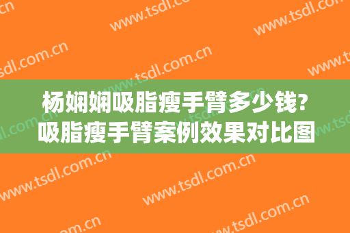 杨娴娴吸脂瘦手臂多少钱?吸脂瘦手臂案例效果对比图_上海交通大学医学院附属第九人民医院