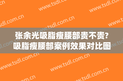 张余光吸脂瘦腰部贵不贵?吸脂瘦腰部案例效果对比图_上海交通大学医学院附属第九人民医院