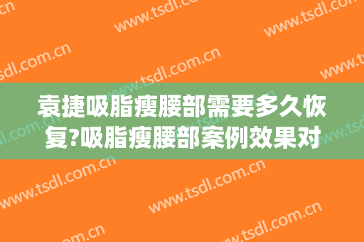 袁捷吸脂瘦腰部需要多久恢复?吸脂瘦腰部案例效果对比图_上海交通大学医学院附属第九人民医院