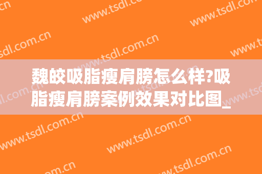 魏皎吸脂瘦肩膀怎么样?吸脂瘦肩膀案例效果对比图_上海交通大学医学院附属第九人民医院