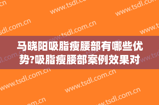 马晓阳吸脂瘦腰部有哪些优势?吸脂瘦腰部案例效果对比图_中国医学科学院整形外科医院