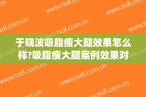 于晓波吸脂瘦大腿效果怎么样?吸脂瘦大腿案例效果对比图_中国医学科学院整形外科医院