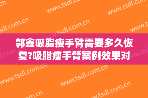 郭鑫吸脂瘦手臂需要多久恢复?吸脂瘦手臂案例效果对比图_中国医学科学院整形外科医院