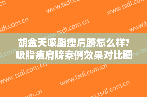 胡金天吸脂瘦肩膀怎么样?吸脂瘦肩膀案例效果对比图_中国医学科学院整形外科医院