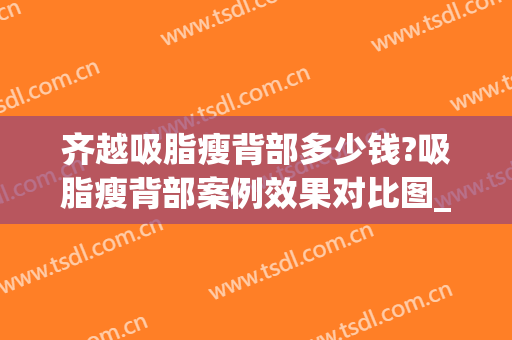 齐越吸脂瘦背部多少钱?吸脂瘦背部案例效果对比图_中国医学科学院整形外科医院