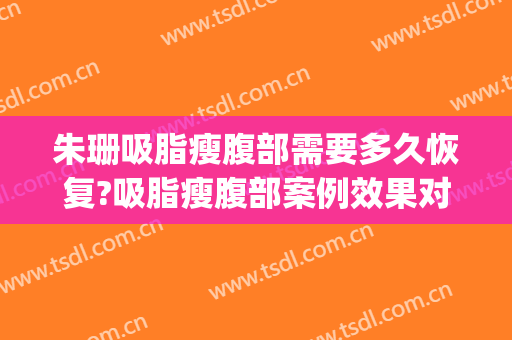 朱珊吸脂瘦腹部需要多久恢复?吸脂瘦腹部案例效果对比图_中国医学科学院整形外科医院