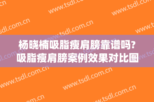 杨晓楠吸脂瘦肩膀靠谱吗?吸脂瘦肩膀案例效果对比图_中国医学科学院整形外科医院