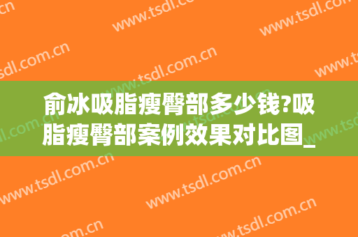 俞冰吸脂瘦臀部多少钱?吸脂瘦臀部案例效果对比图_中国医学科学院整形外科医院