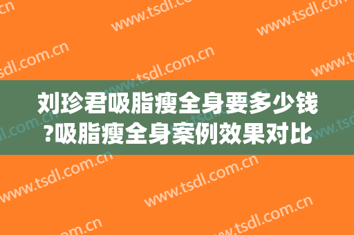 刘珍君吸脂瘦全身要多少钱?吸脂瘦全身案例效果对比图_中国医学科学院整形外科医院