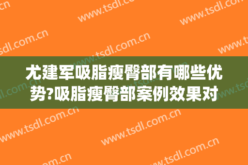 尤建军吸脂瘦臀部有哪些优势?吸脂瘦臀部案例效果对比图_中国医学科学院整形外科医院